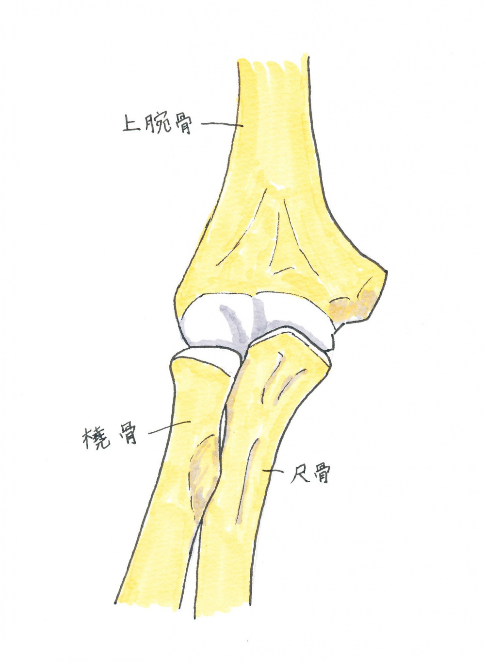 足の歪み