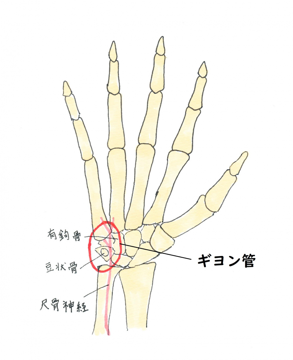 腰の歪み